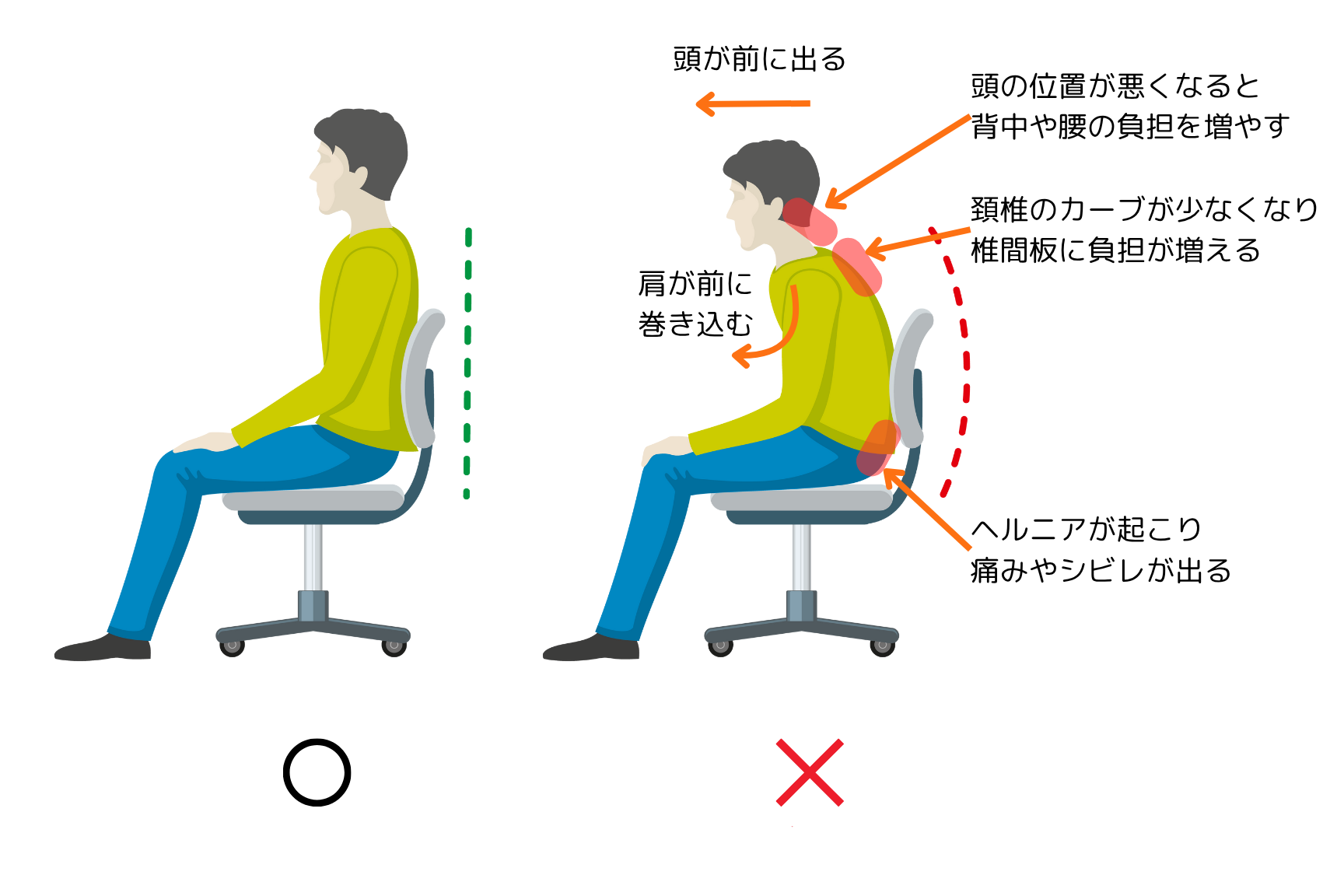 hernia-posture