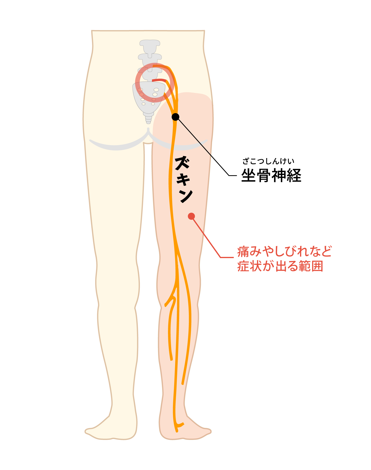 sciatic_nerve