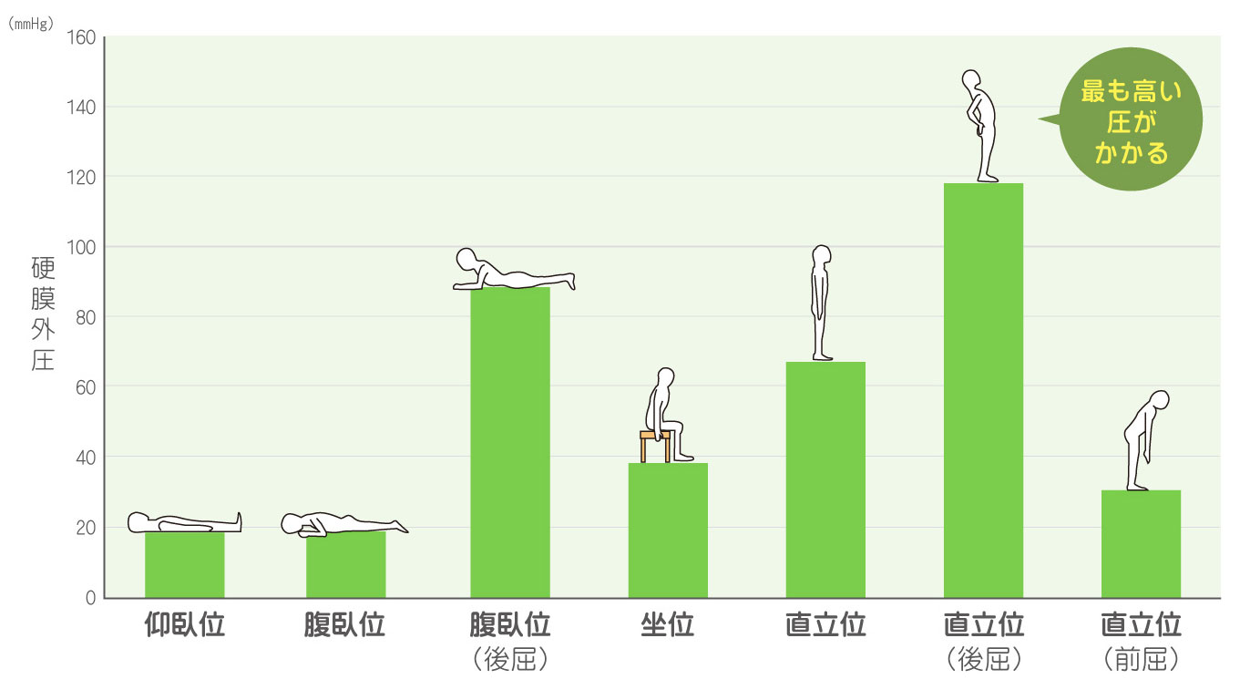 ushi-sekkotu-posture and epidural pressure
